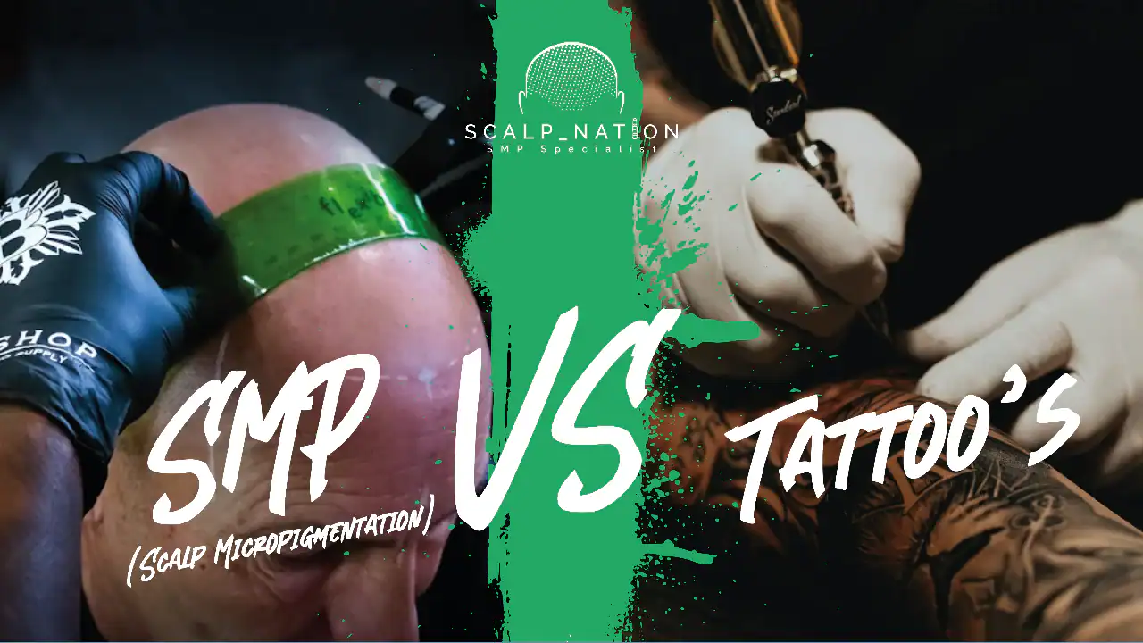 scalp micropigmentation vs tattoo