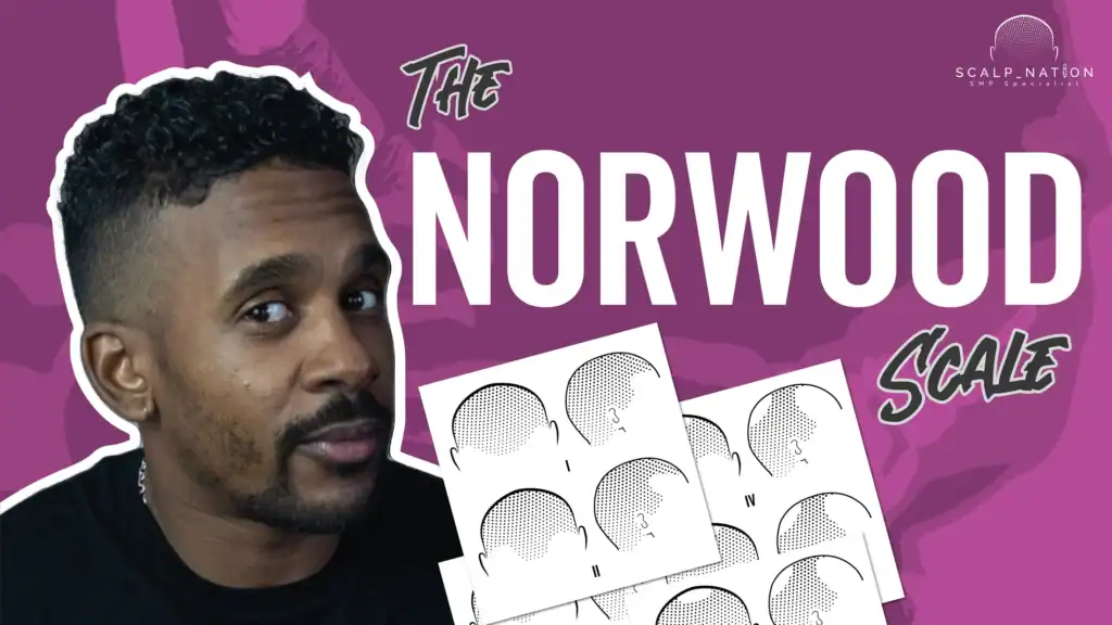 Norwood Scale