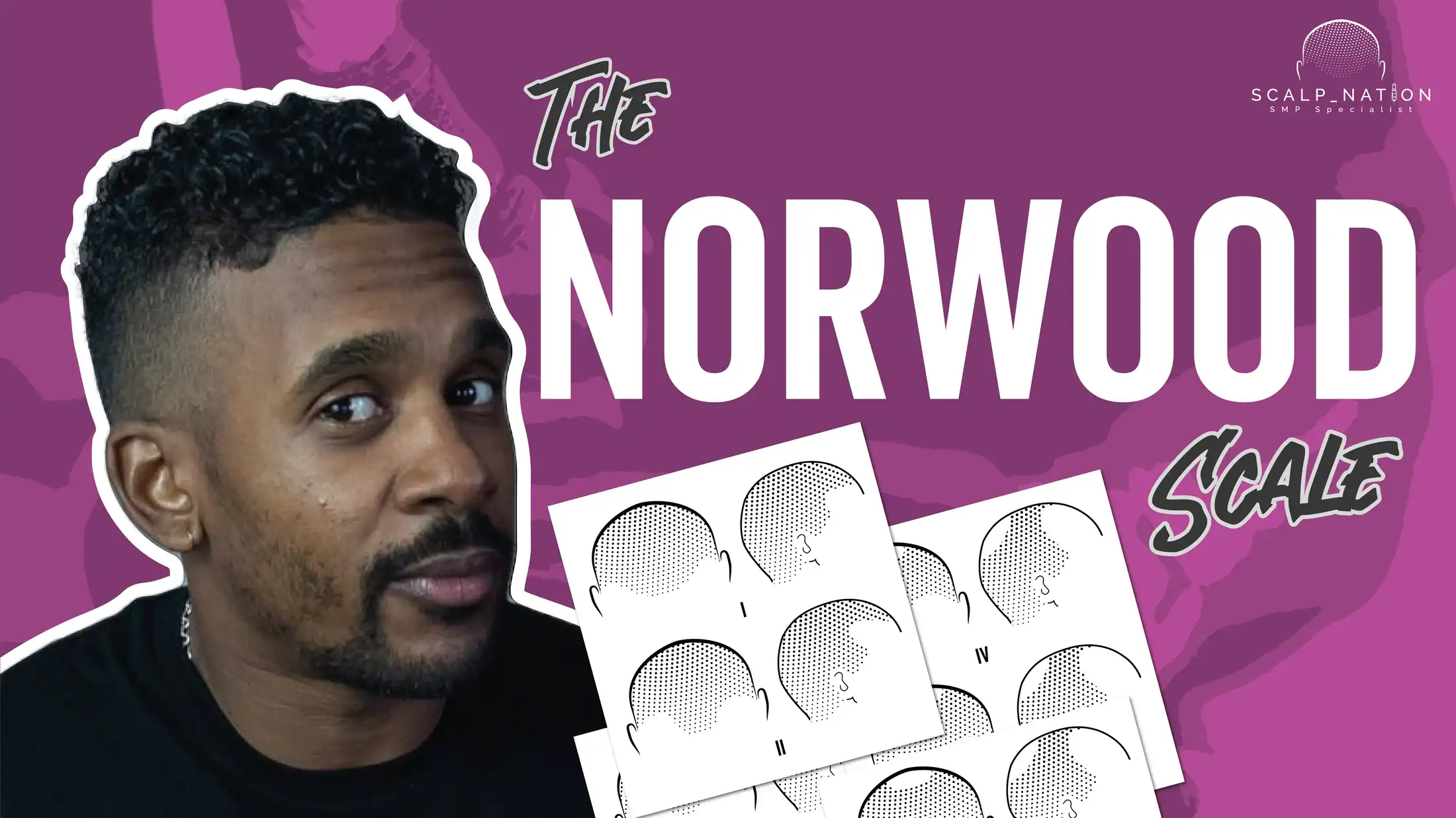 Norwood Scale