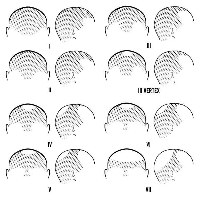 COSTS 11 norwood scale 1 to 7 example 1024x1024