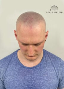AFTER Studio Light Front 29