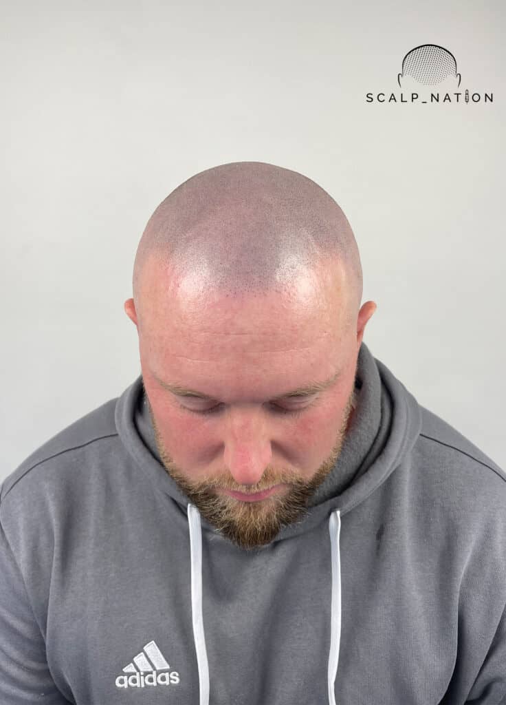 AFTER Studio Light Front 33
