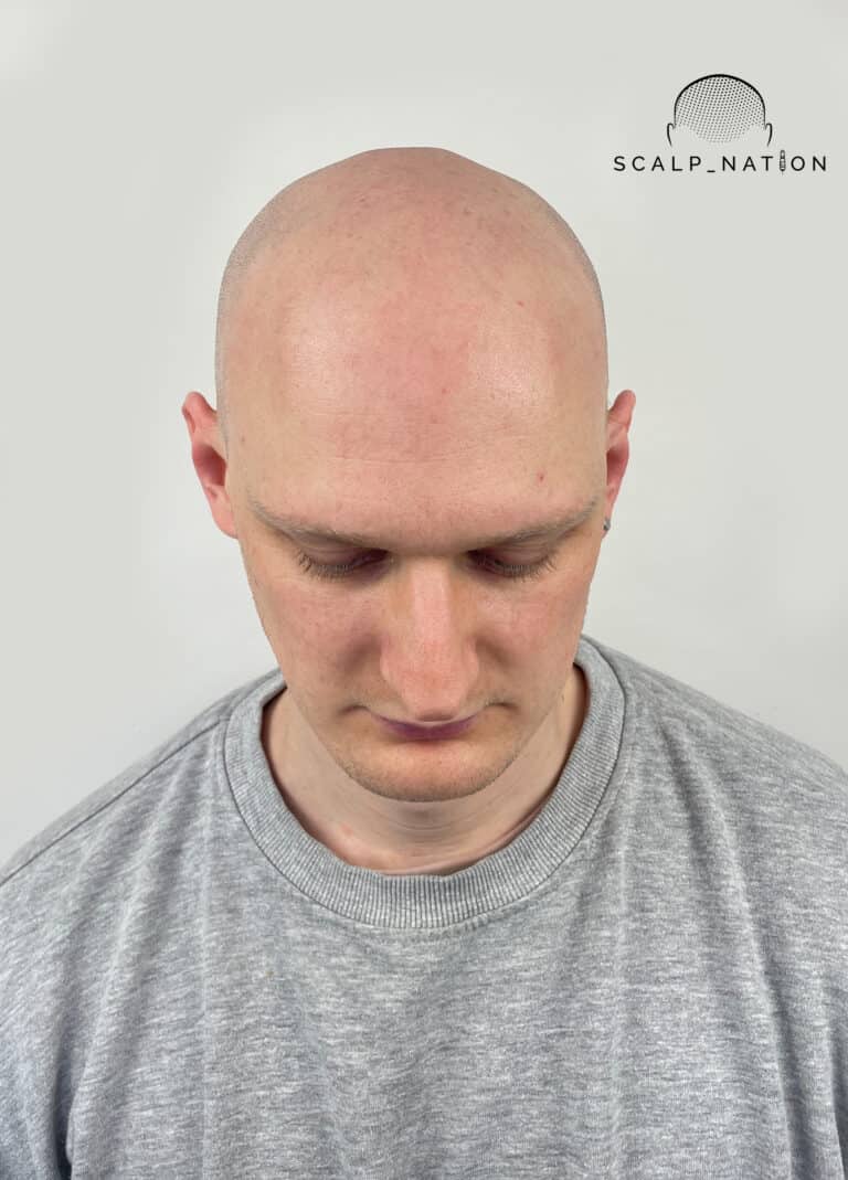BEFORE Studio Light Front 30