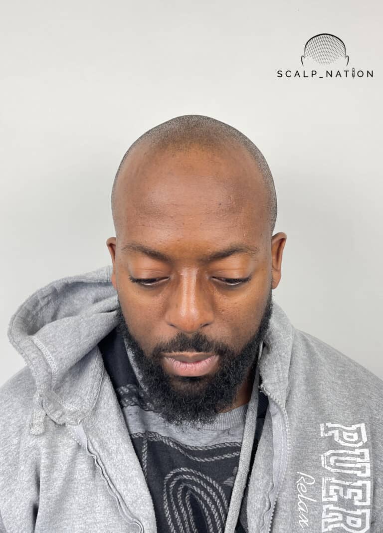 BEFORE Studio Light Front 32